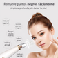 Sistema de Limpieza Facial Profunda en Casa Elimina Puntos Negros Sin Dolor ni Daño a la Piel